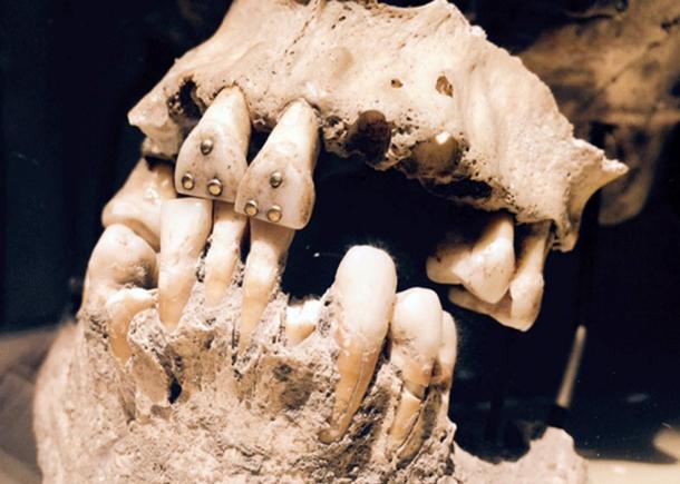 1,600-Year-Old Elongated Skull with Stone-Encrusted Teeth Found in Mexico Ruins