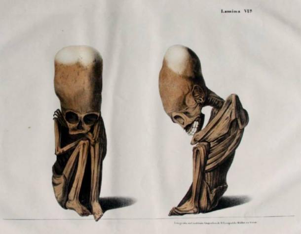 Elongated Skulls in utero: A Farewell to the Artificial Cranial Deformation Paradigm?