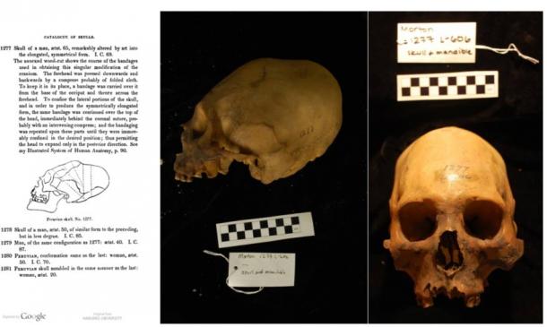 Elongated Skulls in utero: A Farewell to the Artificial Cranial Deformation Paradigm?