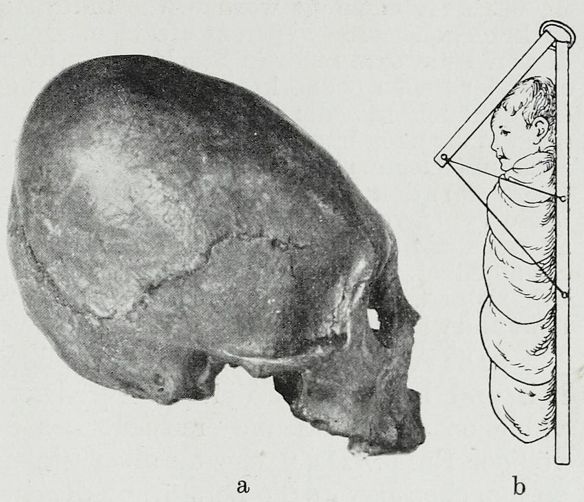 The Mystery of Peru’s Elongated Skulls – Science vs Myth — Louis Wolf