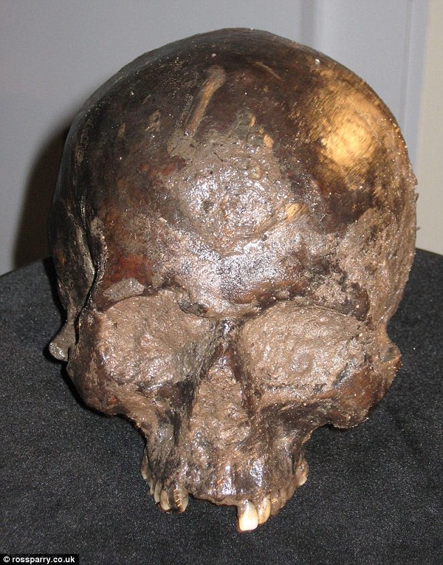 Unlocking Mysteries: 2,600-Year-Old Beheaded Man’s Brain Defies Decay!